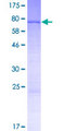 PNMA5 Protein - 12.5% SDS-PAGE of human PNMA5 stained with Coomassie Blue