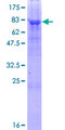 PNPLA3 / Adiponutrin Protein - 12.5% SDS-PAGE of human PNPLA3 stained with Coomassie Blue