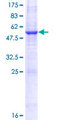 PNPLA4 Protein - 12.5% SDS-PAGE of human PNPLA4 stained with Coomassie Blue