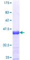 PNPLA6 / NTE Protein - 12.5% SDS-PAGE Stained with Coomassie Blue.