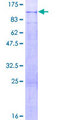 PODN Protein - 12.5% SDS-PAGE of human PODN stained with Coomassie Blue