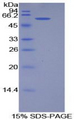 PODXL / Podocalyxin Protein - Recombinant Podocalyxin By SDS-PAGE