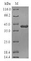 POLR1D Protein - (Tris-Glycine gel) Discontinuous SDS-PAGE (reduced) with 5% enrichment gel and 15% separation gel.