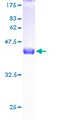 POLR2H / RPB8 Protein - 12.5% SDS-PAGE of human POLR2H stained with Coomassie Blue