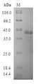 POP7 Protein - (Tris-Glycine gel) Discontinuous SDS-PAGE (reduced) with 5% enrichment gel and 15% separation gel.