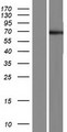 POTEC Protein - Western validation with an anti-DDK antibody * L: Control HEK293 lysate R: Over-expression lysate