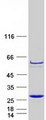 PPCDC Protein - Purified recombinant protein PPCDC was analyzed by SDS-PAGE gel and Coomassie Blue Staining