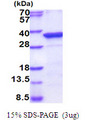 PPM1D / WIP1 Protein