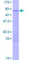 PPM1F Protein - 12.5% SDS-PAGE of human PPM1F stained with Coomassie Blue