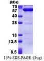 PPM1F Protein