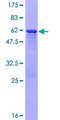 PPM1M Protein - 12.5% SDS-PAGE of human PPM1M stained with Coomassie Blue