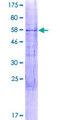 PPM1N Protein - 12.5% SDS-PAGE of human FLJ40125 stained with Coomassie Blue