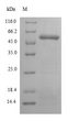 PPOX Protein - (Tris-Glycine gel) Discontinuous SDS-PAGE (reduced) with 5% enrichment gel and 15% separation gel.