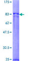 PPOX Protein - 12.5% SDS-PAGE of human PPOX stained with Coomassie Blue