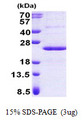 PPP1R11 Protein