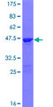 PPP1R27 / DYSFIP1 Protein - 12.5% SDS-PAGE of human DYSFIP1 stained with Coomassie Blue