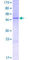 PPP1R42 / LRRC67 Protein - 12.5% SDS-PAGE of human PPP1R42 stained with Coomassie Blue