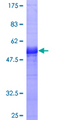 PPP2R3B Protein - 12.5% SDS-PAGE of human PPP2R3B stained with Coomassie Blue
