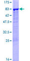 PPP2R5B Protein - 12.5% SDS-PAGE of human PPP2R5B stained with Coomassie Blue