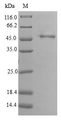 PPP3R2 Protein - (Tris-Glycine gel) Discontinuous SDS-PAGE (reduced) with 5% enrichment gel and 15% separation gel.