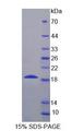 PR / Progesterone Receptor Protein - Recombinant Progesterone Receptor (PGR) by SDS-PAGE