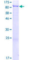 PREPL Protein - 12.5% SDS-PAGE of human PREPL stained with Coomassie Blue