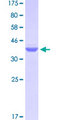 PRKAR1B Protein - 12.5% SDS-PAGE Stained with Coomassie Blue.