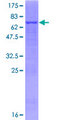 PRMT8 Protein - 12.5% SDS-PAGE of human PRMT8 stained with Coomassie Blue