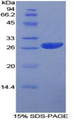 PRNP / PrP / Prion Protein - Recombinant Prion Protein By SDS-PAGE
