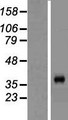 PROCA1 Protein - Western validation with an anti-DDK antibody * L: Control HEK293 lysate R: Over-expression lysate