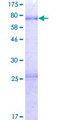 PROCA1 Protein - 12.5% SDS-PAGE of human PROCA1 stained with Coomassie Blue