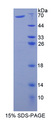 Prothrombin Fragment 1+2 Protein - Recombinant  Prothrombin Fragment 1+2 By SDS-PAGE