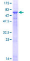 PROZ / Protein Z Protein - 12.5% SDS-PAGE of human PROZ stained with Coomassie Blue