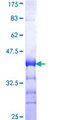 PRPF3 Protein - 12.5% SDS-PAGE Stained with Coomassie Blue.
