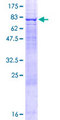 PRPF4 Protein - 12.5% SDS-PAGE of human PRPF4 stained with Coomassie Blue