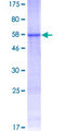 PRPK / TP53RK Protein - 12.5% SDS-PAGE of human TP53RK stained with Coomassie Blue
