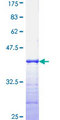 PRPK / TP53RK Protein - 12.5% SDS-PAGE Stained with Coomassie Blue