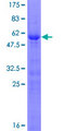 PRRX2 / PRX2 Protein - 12.5% SDS-PAGE of human PRRX2 stained with Coomassie Blue