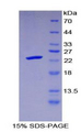 PRSS1 / Trypsin Protein - Recombinant Protease, Serine 1 By SDS-PAGE