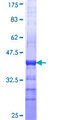 PRSS27 / CAPH2 Protein - 12.5% SDS-PAGE Stained with Coomassie Blue.