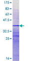 PRY Protein - 12.5% SDS-PAGE Stained with Coomassie Blue.