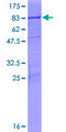 PSD3 Protein - 12.5% SDS-PAGE of human PSD3 stained with Coomassie Blue