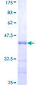 PSF1 / GINS2 Protein - 12.5% SDS-PAGE Stained with Coomassie Blue.