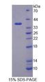 PSG2 Protein - Recombinant Pregnancy Specific Beta-1-Glycoprotein 2 By SDS-PAGE