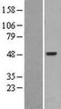 PSKH1 Protein - Western validation with an anti-DDK antibody * L: Control HEK293 lysate R: Over-expression lysate