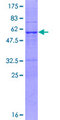 PSMA8 Protein - 12.5% SDS-PAGE of human PSMA8 stained with Coomassie Blue