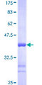PSMC6 Protein - 12.5% SDS-PAGE Stained with Coomassie Blue.