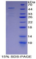 PSMD13 Protein - Recombinant Proteasome 26S Subunit, Non ATPase 13 By SDS-PAGE