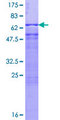 PSMD6 Protein - 12.5% SDS-PAGE of human PSMD6 stained with Coomassie Blue