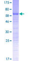 PSRC1 / DDA3 Protein - 12.5% SDS-PAGE of human PSRC1 stained with Coomassie Blue